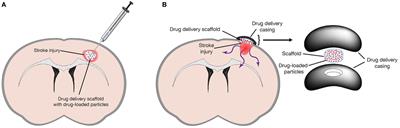 Harnessing the Potential of Biomaterials for Brain Repair after Stroke